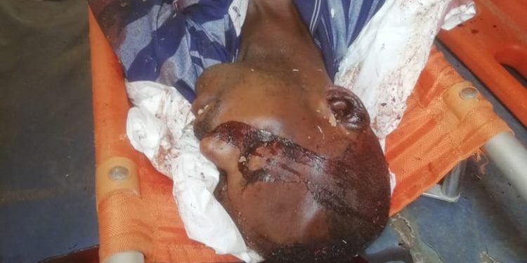 One dead, four injured in separate road accidents in Abuja